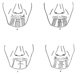 Hupa. Women’s facial styles, 1910.