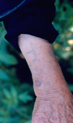 Bosnian Catholic tattoos, ca. 1908.