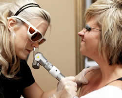 Tattoo removal